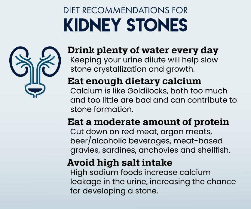 Kidney Stones - South Valley Urology
