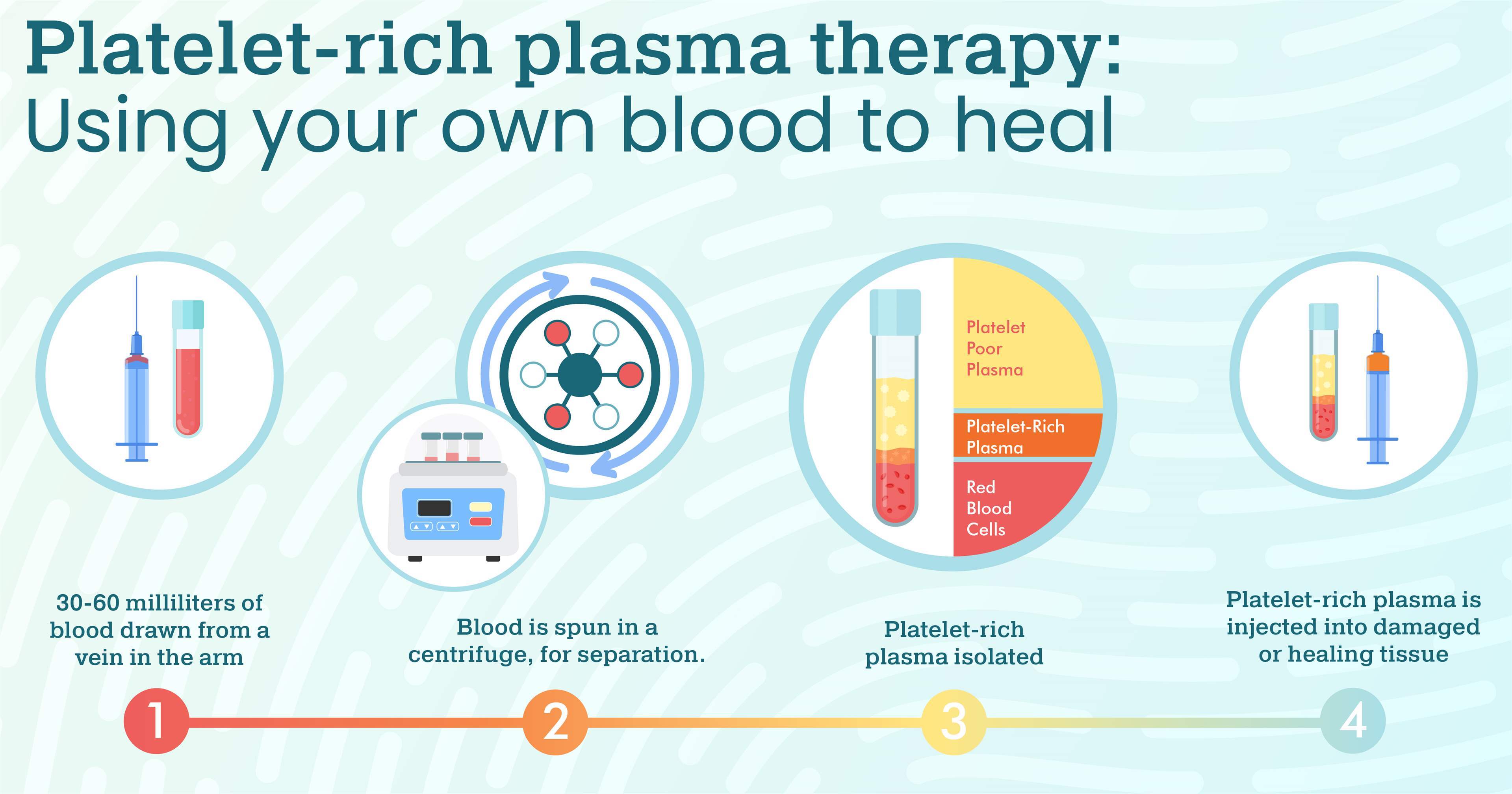 How Much Does 880 Ml Of Plasma Sell For 45 - 7umvmqs